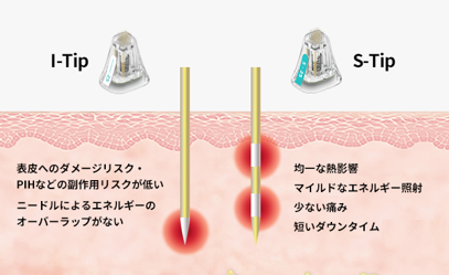 コーティング針で表皮の熱ダメージ0