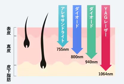 医療脱毛の効果を実感していただける、それが「スプレンダーX」