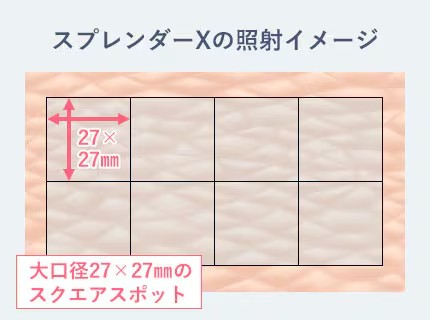 医療脱毛の効果を実感していただける、それが「スプレンダーX」