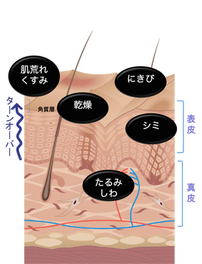 ダメージのある皮膚とは